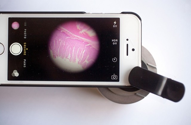 iphone_microscope001-640x426